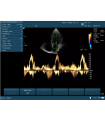 radio avec couleur et variation Echographe portable U50