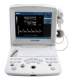 Echographe Portable DUS 60 vue de face
