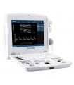 Echographe Portable DUS 60 vue de gauche