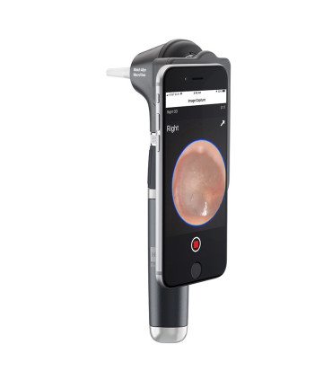 Otoscope Macroview Plus iExaminer Welch Allyn - Direct Médical