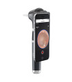 Otoscope Macroview Plus iExaminer Welch Allyn - Direct Médical