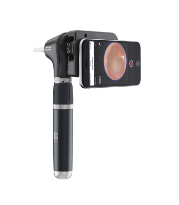 Otoscope Macroview Plus iExaminer Welch Allyn - Direct Médical