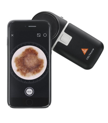 Dermatoscope DELTAOne HEINE - Présentation utilisation avec smartphone - Direct Médical