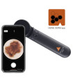 Dermatoscope HEINE DELTA 30 Pro Noir avec smartphone et logo application mobile "HEINE DERM" - Direct Médical