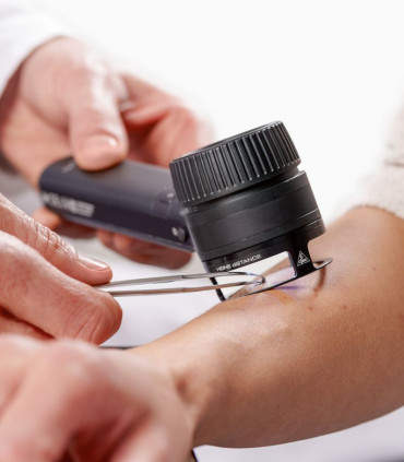 Bague de travail distance pour Dermatoscope DELTA 30 / 30 PRO en utilisation HEINE